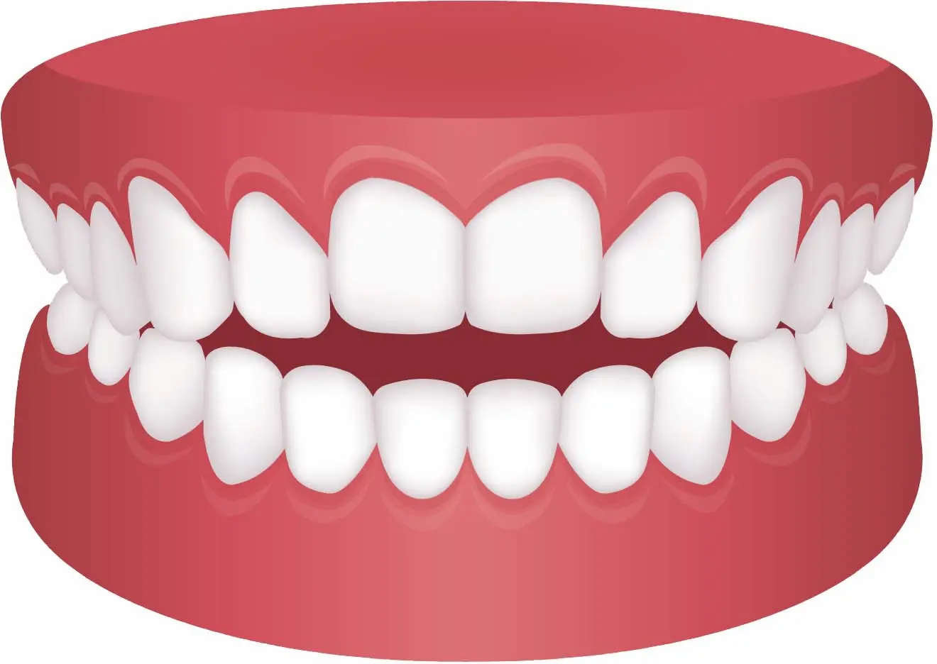 اپن بایت و ارتودنسی