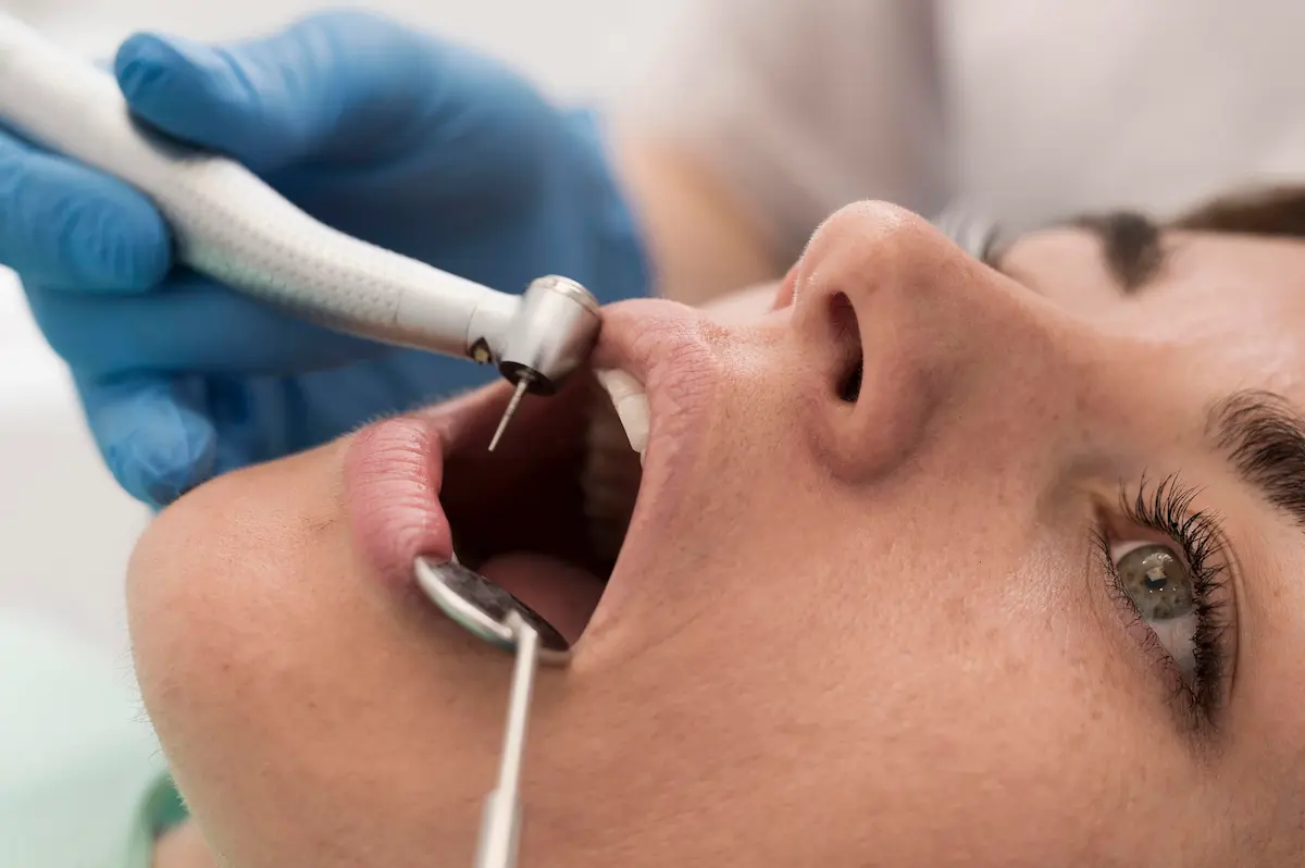 جرم گیری دندان در طول ارتودنسی