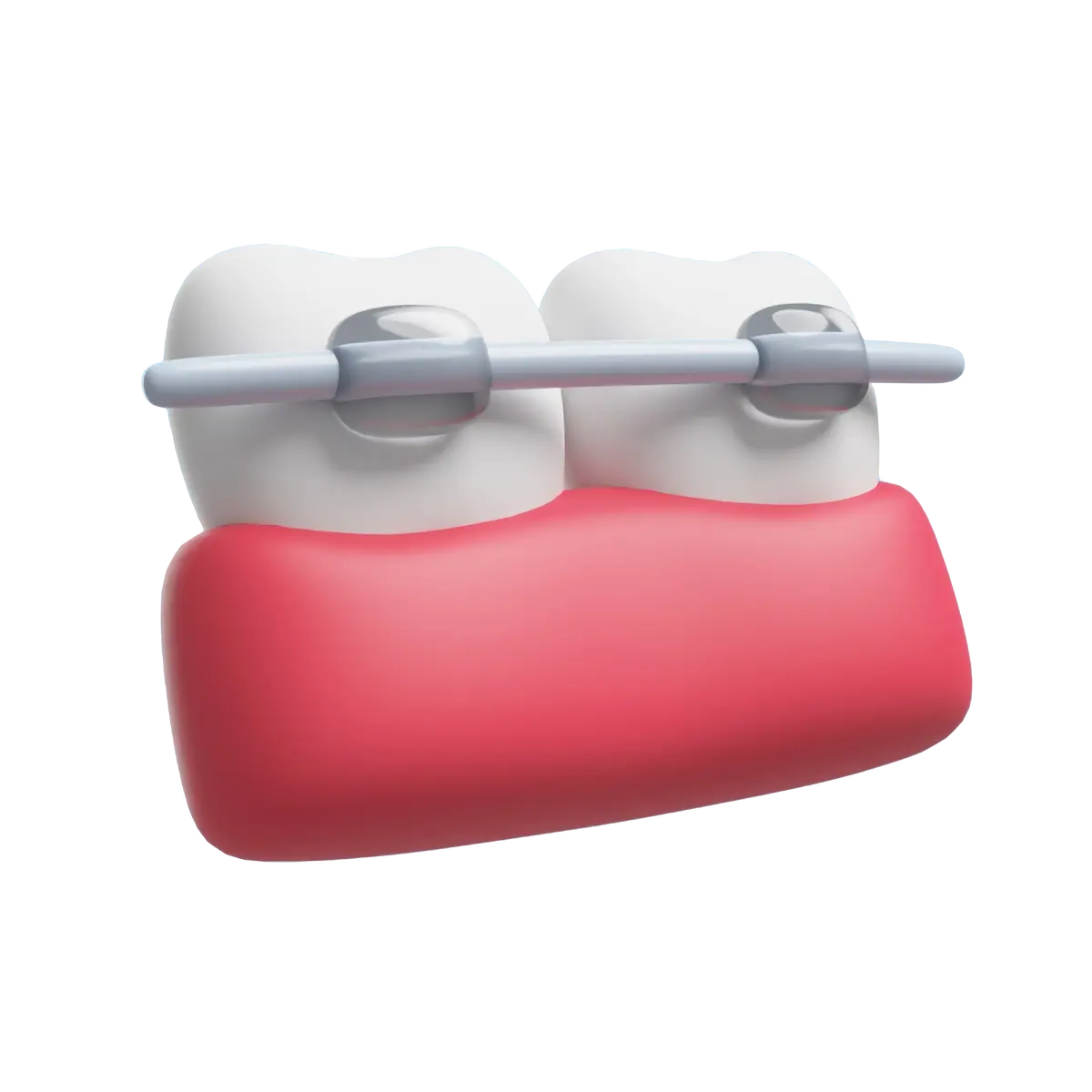 ارتودنسی دو دندان متخصص