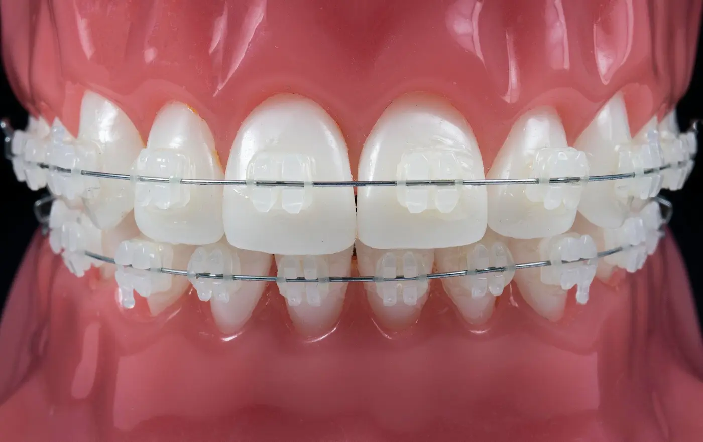 متخصص ارتودنسی سرامیکی در تهران