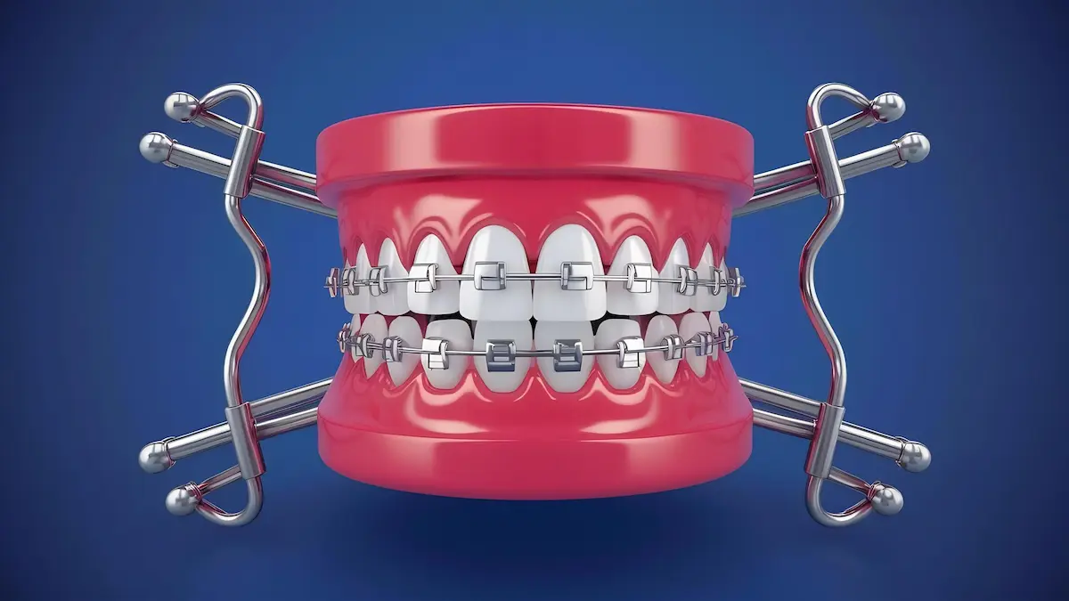 متخصص ارتودنسی خوب تهران