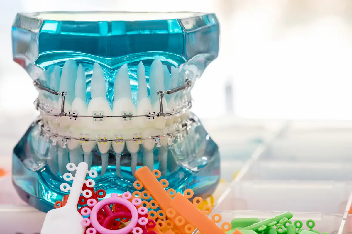 تخصص ارتودنسی