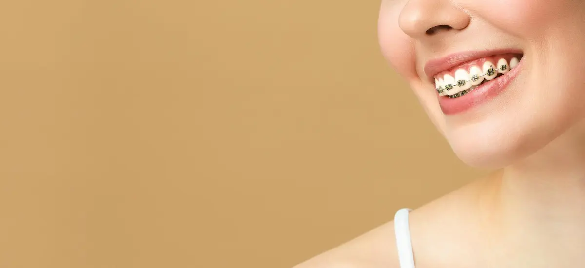 متخصص ارتودنسی تهران