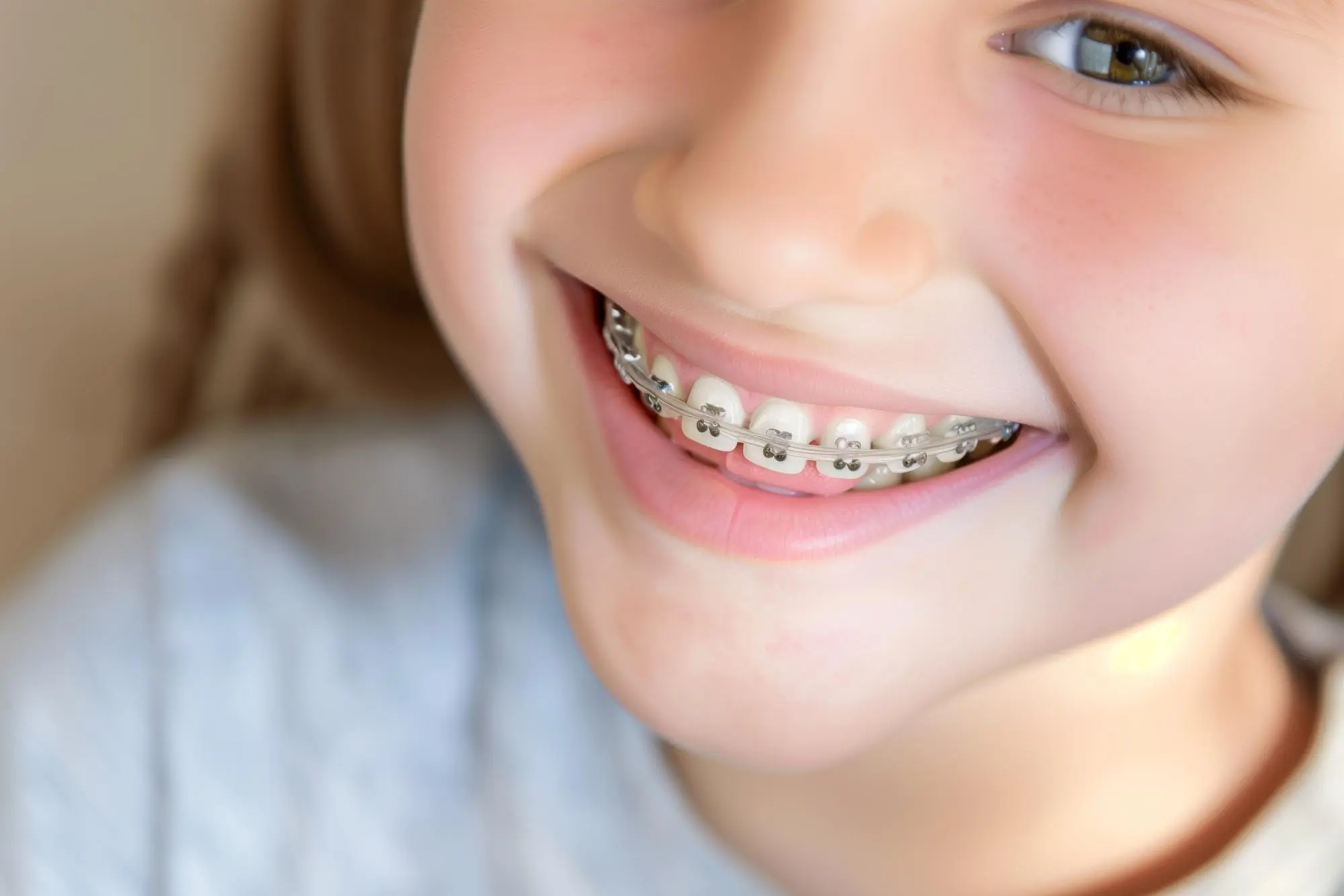 متخصص ارتودنسی خوب در تهران